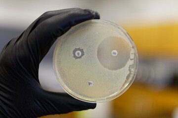 A Pertri plate showing the resistance of bacteria to antibiotics. If the bacteria is resistant the...