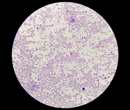 Culture colonies gram stain microscopic shoe staphylococcus aureus bacteria.
