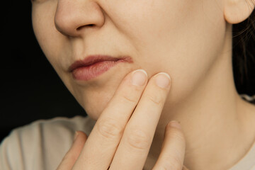 Lip herpes and Angular cheilitis on womans face. Beauty skin female face. Girl facial treatment....