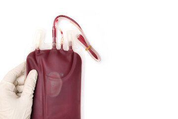 A hand in a glove holding a blood bag.   Blood transfusion and blood donation concept. - obrazy, fototapety, plakaty