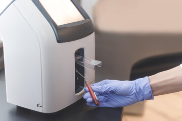 Laboratory worker inserts blood tube into animal electrolyte analyzer.