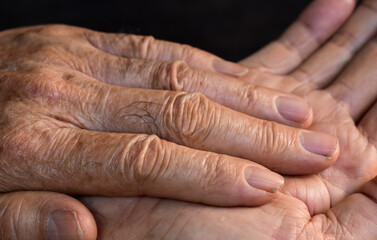 Fototapeta premium Fingers of Asian man. Concept of hand pain, arthritis and finger problems.