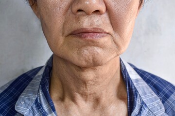 Aging skin folds or skin creases or wrinkles of Asian Chinese old man.