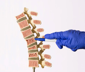 Doctor using hand to demonstrate artificial human spine model in the medical office. The doctor shows with a hand in a glove osteoporosis of the spine. - obrazy, fototapety, plakaty