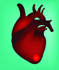 A sick heart. This illustration can be useful for medical and science materials. Vector illustration.
