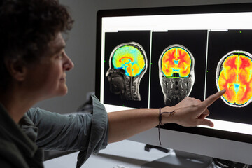 Female analyzing brain scan on computer