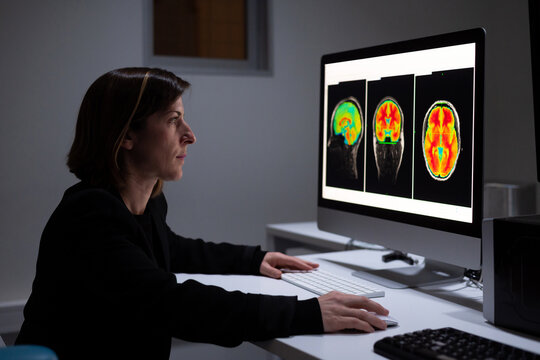 Female analyzing brain scan on computer