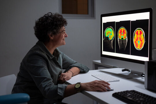 Female analyzing brain scan on computer