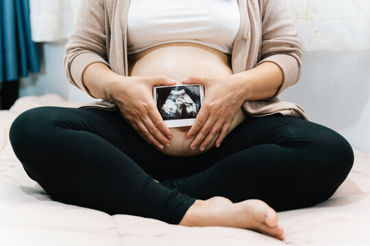 A Pregnant woman in dress with ultrasound image. Expectant mother waiting and preparing for baby birth during pregnancy.