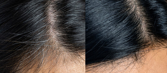 Compare grey hair on Asian woman head before and after dyed, close up.