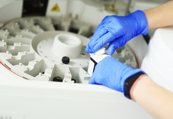 laboratory assistant in blue rubber gloves adds a reagent to the centrifuge of a modern biochemical analyzer. - obrazy, fototapety, plakaty