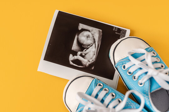 Tiny baby's shoes and a board with the inscription "coming soon". Pregnancy concept and expecting baby