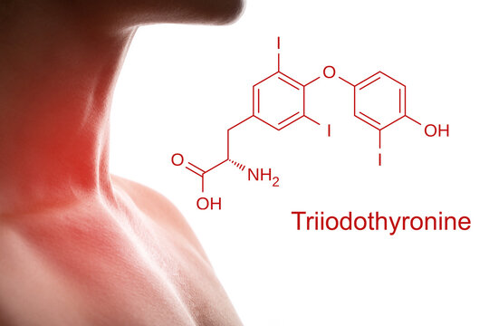Female neck and triiodothyronine hormone formula