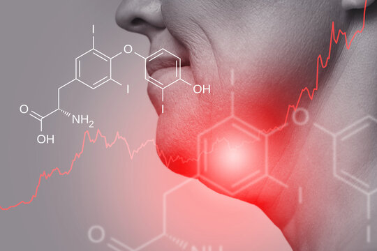 Female neck and triiodothyronine hormone formula