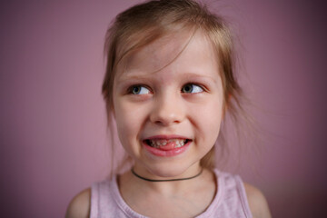 girl smiles without a front tooth. High quality photo