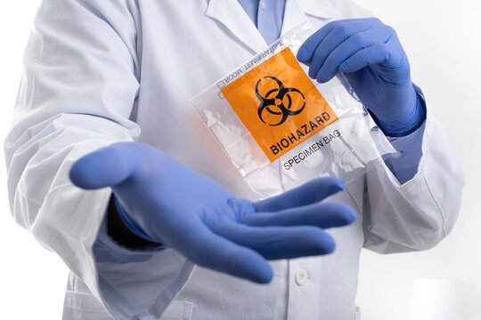Doctor Scientist ask gesture, holds a Biohazard specimen bag in hand. Laboratory Leaks  Bioweapons concept. Rapid Test covid. Close up selective focus