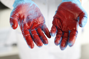 Doctor hands in rubber gloves with blood closeup