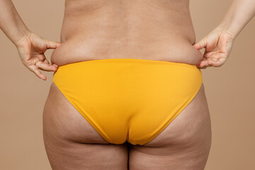Cropped image of overweight fat naked woman bottom hips, excess fat in yellow underwear. Dangling...