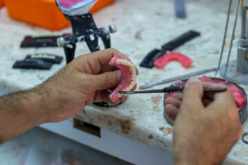 denture making