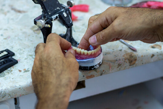 Denture Making