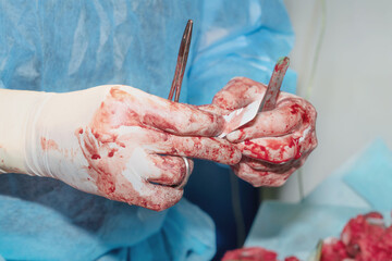 Hands of a surgeon during surgery open threads for suturing wounds. Gloves smeared with blood.