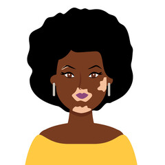 African Woman with Vitiligo on Dark Skin, Self Love. Vector flat illustration