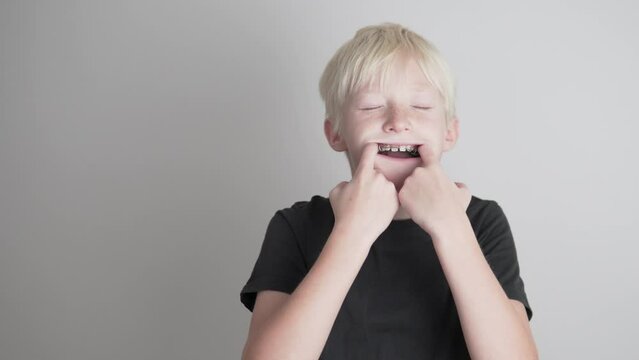 Close-up, a teenage boy pulls out a corrective plate from his mouth to align his teeth and correct his bite.