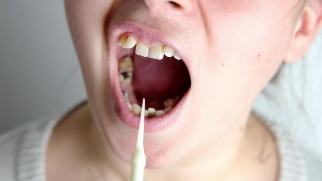 dentist, doctor examines oral cavity of female patient, uses mouth mirror, closeup teeth young woman, concept dentistry, dental treatment, dental prosthetics, oral care, caries prevention