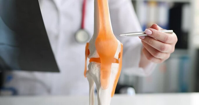 Doctor with xray in his hands showing structure of knee joint on artificial model closeup 4k movie