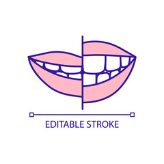 Changing teeth size RGB color icon. Improving smile and teeth appearance. Cosmetic dental treatment. Isolated vector illustration. Simple filled line drawing. Editable stroke. Arial font used