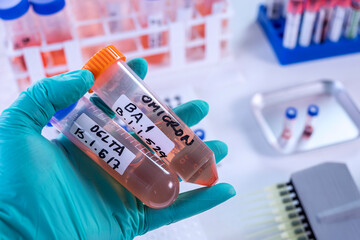 Scientist in laboratory holding vials for sars-cov2 Delta and Omicron variant research, concept...