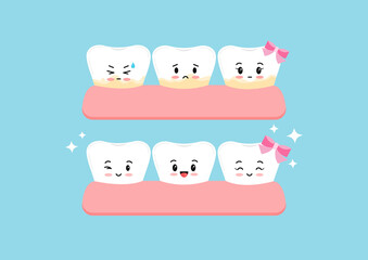 Cute white tooth and with yellow tartar plaque before after kids icon set. Teeth in gum kawaii character stain treatment, remove and cleaning concept. Flat cartoon vector illustration. 