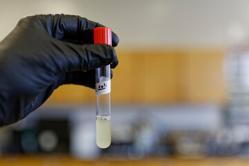E. coli culture in a test tube. This organism lives in the intestinal tract of warm-blooded animals.