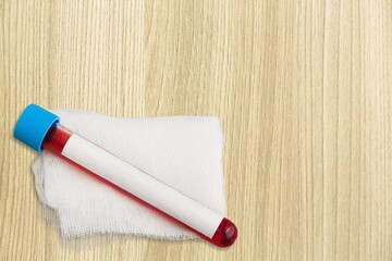 Blood tube for test detection of virus Covid-19 Variant with positive result
