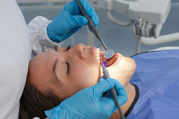 close-up of young woman face being examined by the dentist at the dental clinic