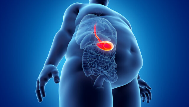 3d rendered illustration of an obese mans stomach