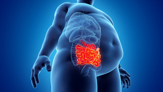 3d rendered illustration of an obese mans small intestine