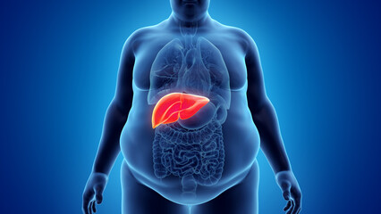 3d rendered illustration of an obese mans liver