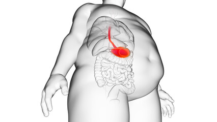 3d rendered illustration of an obese mans stomach