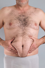 Obesity epidemic awareness and unhealthy eating habits concept with an overweight man with a hairy chest pinching the fat underneath the belly, isolated on gray background , no faces shown