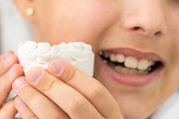 Teenager is holding a dental cast model at the start of orthodontic treatment alongside her teeth after the treatment was completed.