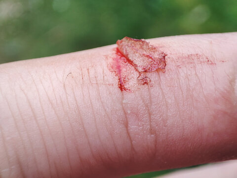 Injured finger with bleeding open cut. Deep wound. the injured finger with a dirty open background