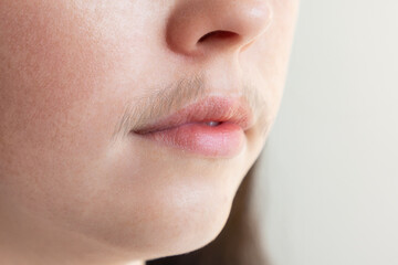 A close-up of caucasian woman's face with a mustache over her upper lip. The concept of hair removal and depilation