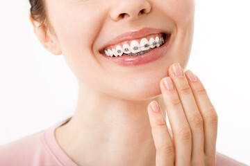 Smile with Braces Orthodontic Treatment. Dental Care Concept. Beautiful Woman Healthy Smile close...