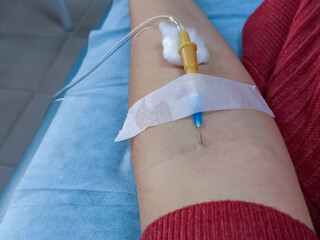 Hand with dropper needle and anesthesia injection.