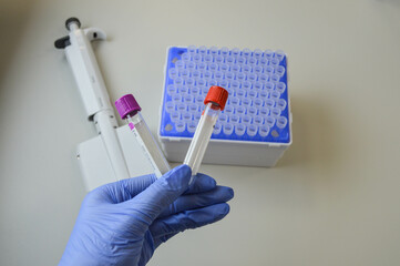 a doctor in a blue glove holds in his hand two test tubes for performing analyzes with multi-colored caps. against the background of a mechanical dispenser for performing analyzes. laboratory