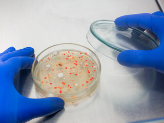 The scientist slightly opened the lid of the petri dish to see the bacterial colonies, close-up. A...