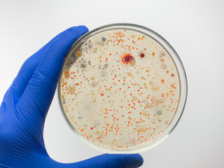 Study of bacteria in a petri dish. A hand in a blue glove holds a cup with different red colonies of bacteria.