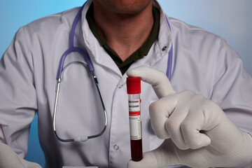 Doctor demonstrates blood analysis test-tube. Vacutainer with blood test. Nurse shows test tube with red liquid. Physician guy with blood test. Medic control of danger infections and sugar control.