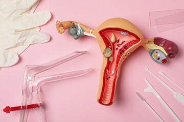 Gynecological examination kit and anatomical uterus model on pink background, flat lay